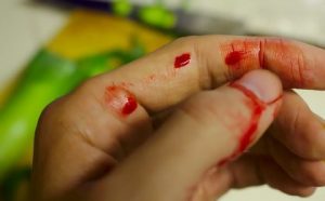 Blut auf der Hand oder auf dem Finger nach dem Sex