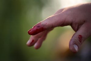 Blutige Hand, Finger: Gefahr einer HIV-Übertragung / Aids-Ansteckung?