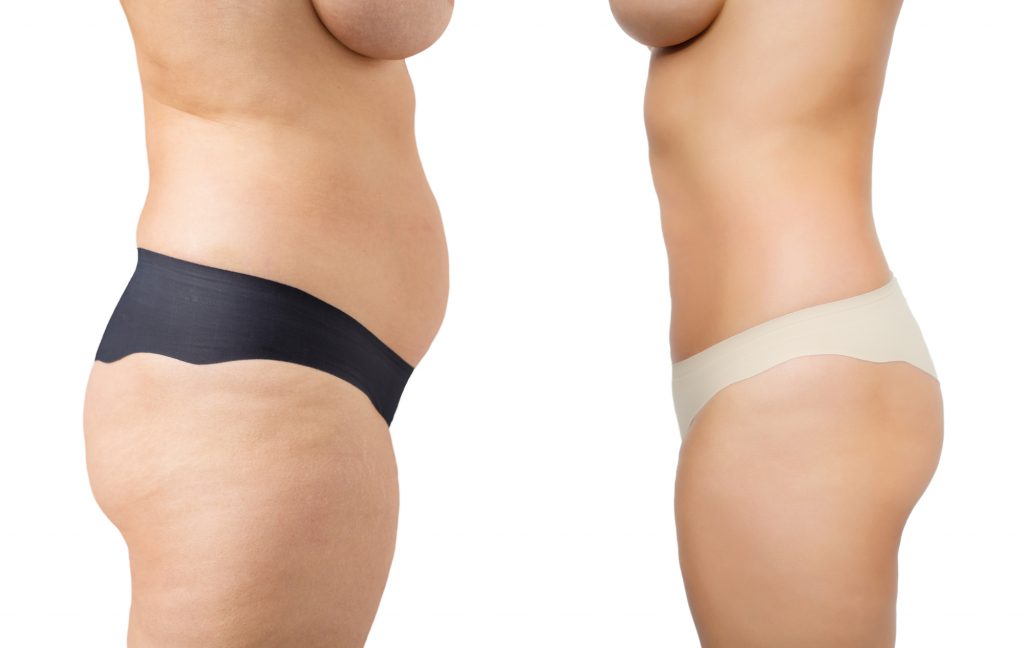 Schlank im Bett: Kann man durch Sex abnehmen?