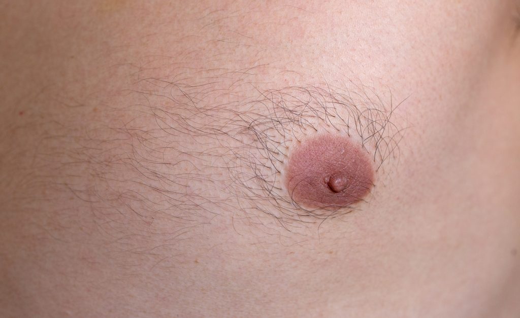 Sie hat Haare auf der Brust, vor allem um die Brustwarzen!