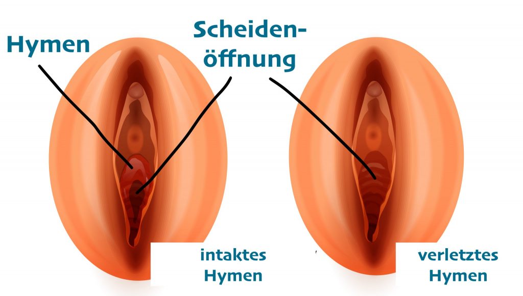 Jungfernhäutchen/ Hymen: Wie sieht das eigentlich aus und wo reißt es ein?