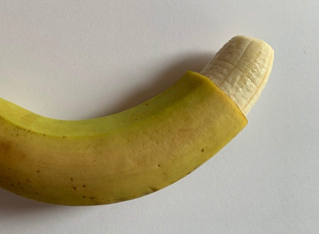 Beschneidung: Soll ich die Vorhaut ganz oder nur zur Hälfte entfernen lassen?