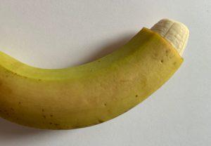 Beschnittener Penis, bei Beschneidung Vorhaut halb ab