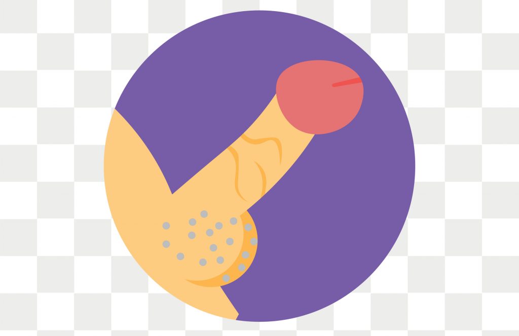 Wo ist die Eichel und wie soll ich sie berühren?